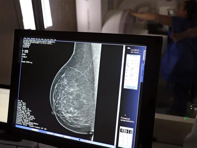 Nova lei reforça direito a três folgas por ano para exames preventivos